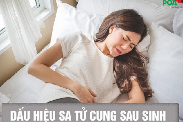 7 dấu hiệu Sa tử cung sau sinh, các mẹ đừng chủ quan!